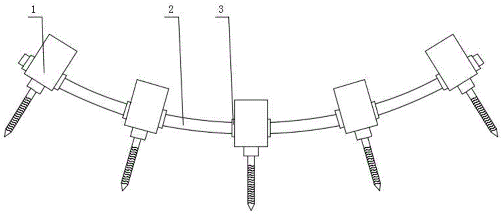 一种脊柱钉棒固定系统的制作方法