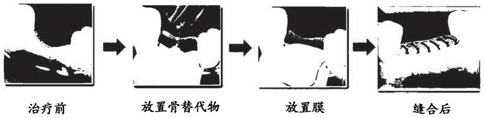 用于骨组织再生的集成生物材料及其制备方法与流程