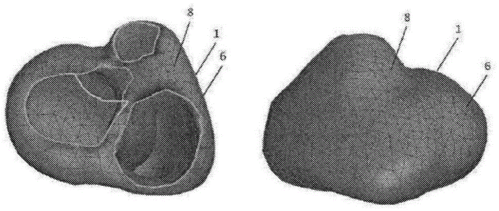 心脏标测和模型合并的方法与流程