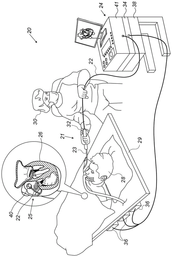 球囊推进机构的制作方法