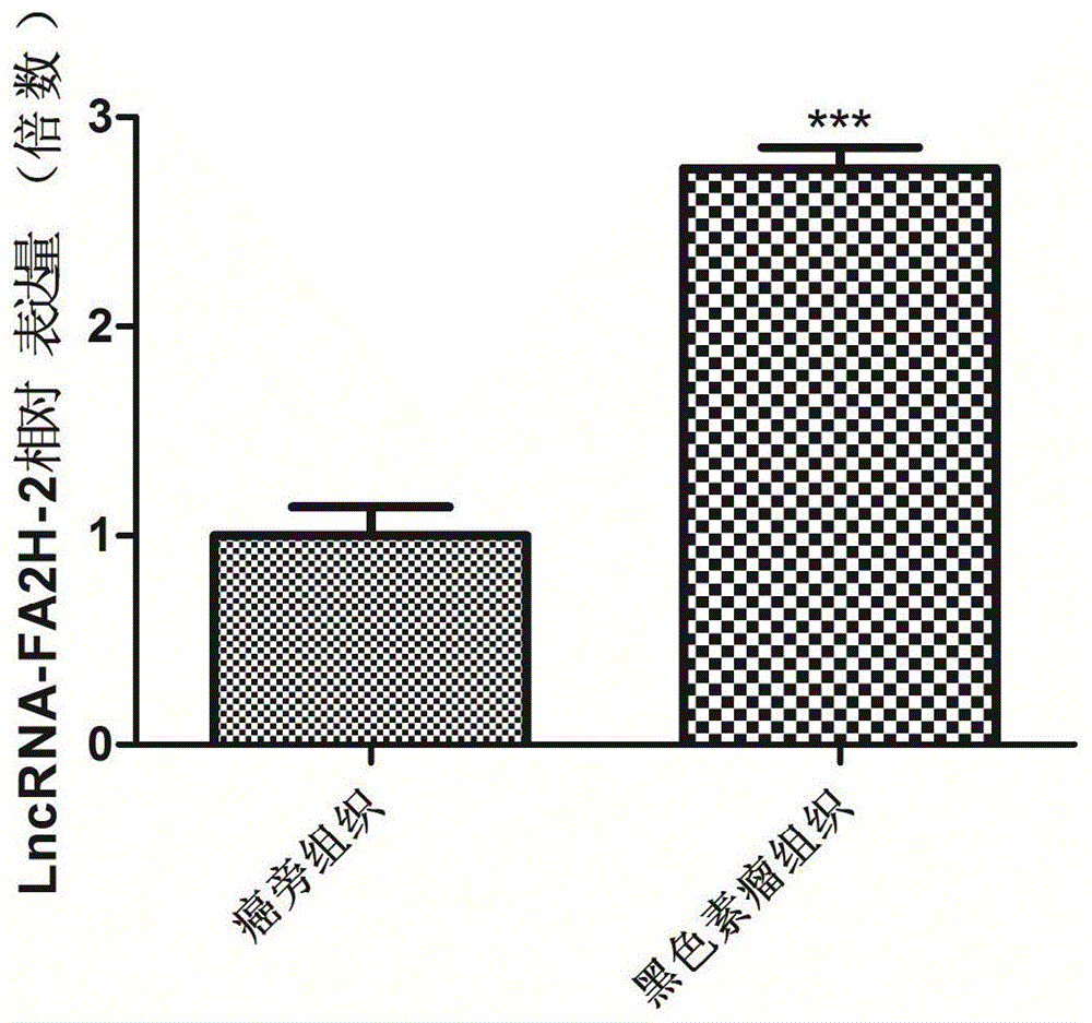 一种用于检测黑色素瘤的长非编码RNA及其应用的制作方法