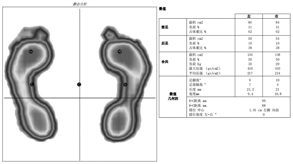 一种基于走路不稳的增材制造矫形鞋垫的制作方法与流程