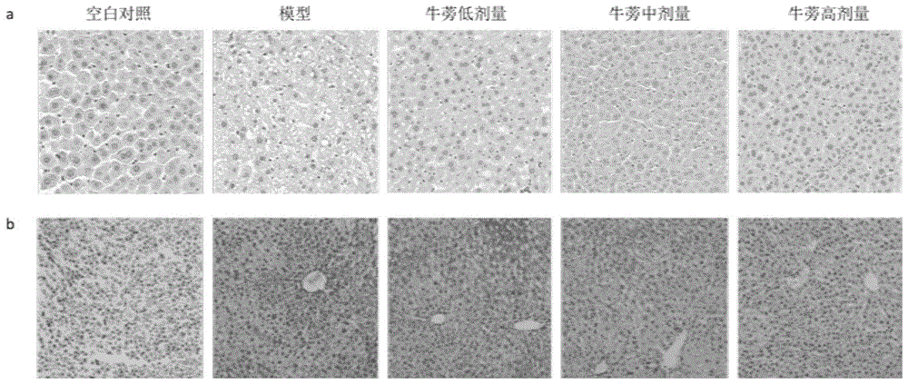 牛蒡根多糖在制备治疗非酒精性脂肪肝药物中的应用的制作方法