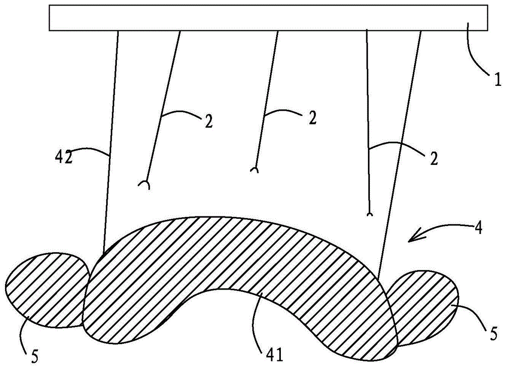舌侧保持器转移工具的制作方法