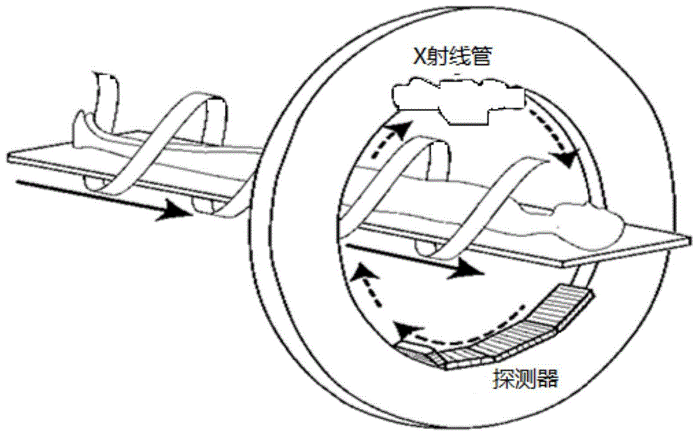 螺旋CT扫描重建图像的方法和装置与流程