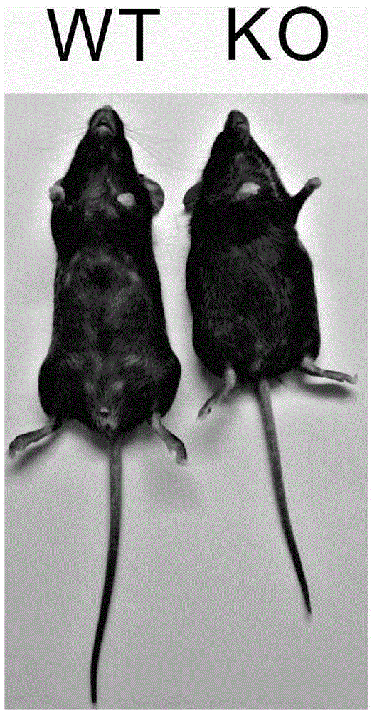 ECM1基因敲除小鼠在抗肝纤维化药物筛选中的应用的制作方法