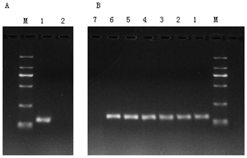 一种检测鸭疫里默氏菌的荧光定量PCR引物组及其检测方法与流程