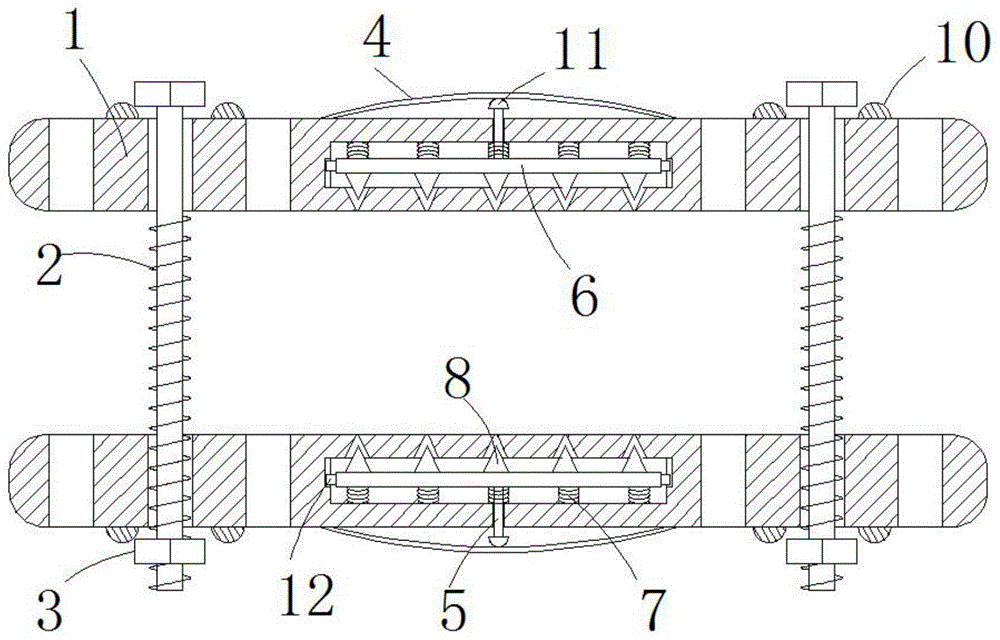 一种智能防断骨科钢板的制作方法