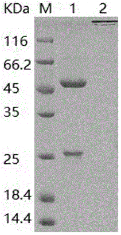 抗HPV31L1的单克隆中和抗体及其应用的制作方法