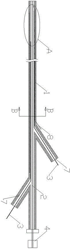 可调弯的覆膜支架开口刺针装置的制作方法