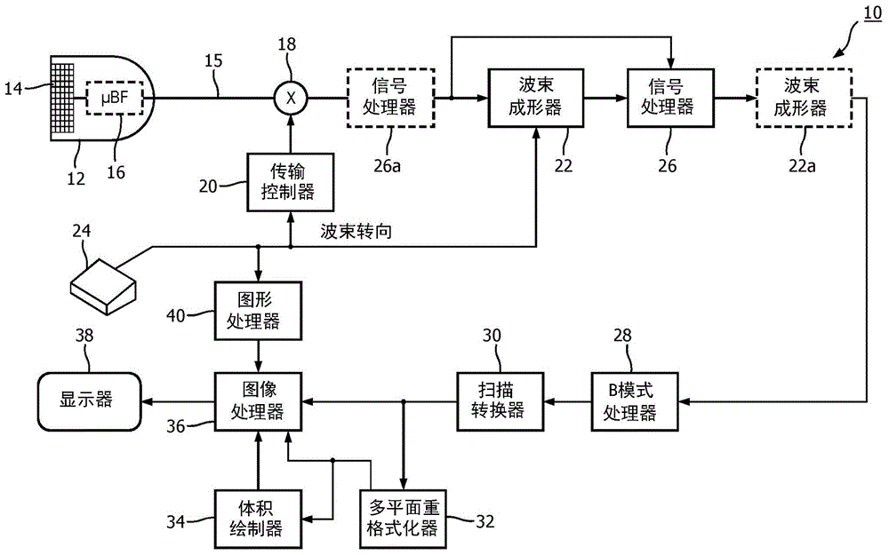 用于对声学杂波和随机噪声的滤波的方法和系统与流程