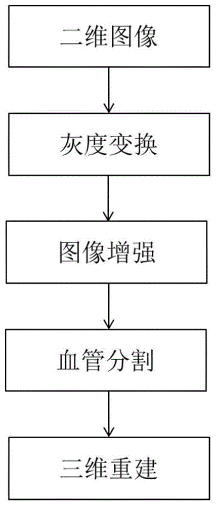 一种基于造影技术的脑血管疾病成像方法及应用的造影剂与流程