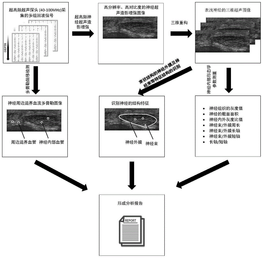 表浅神经的超声成像及图像分析方法与流程