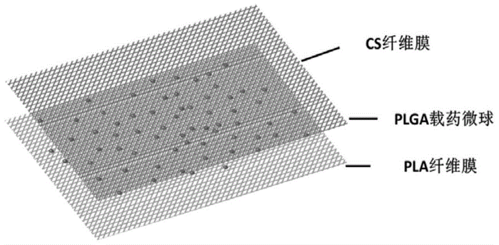 载生物活性因子PLA/PLGA/CS复合膜及其制备方法与流程