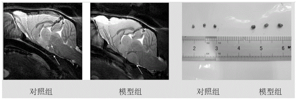NLRP3炎性小体的抑制剂在制备治疗垂体腺瘤的药物中的应用及治疗垂体腺瘤的药物的制作方法