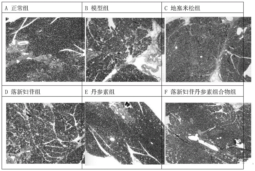 一种用于治疗胰腺炎的药物组合物的制作方法