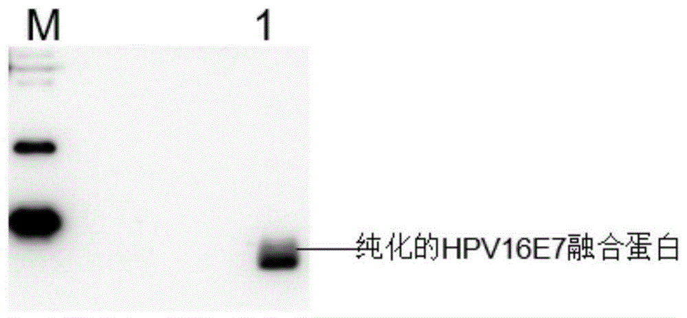 抗HPV16E7蛋白单抗79A11、杂交瘤细胞株及其制备方法和应用与流程