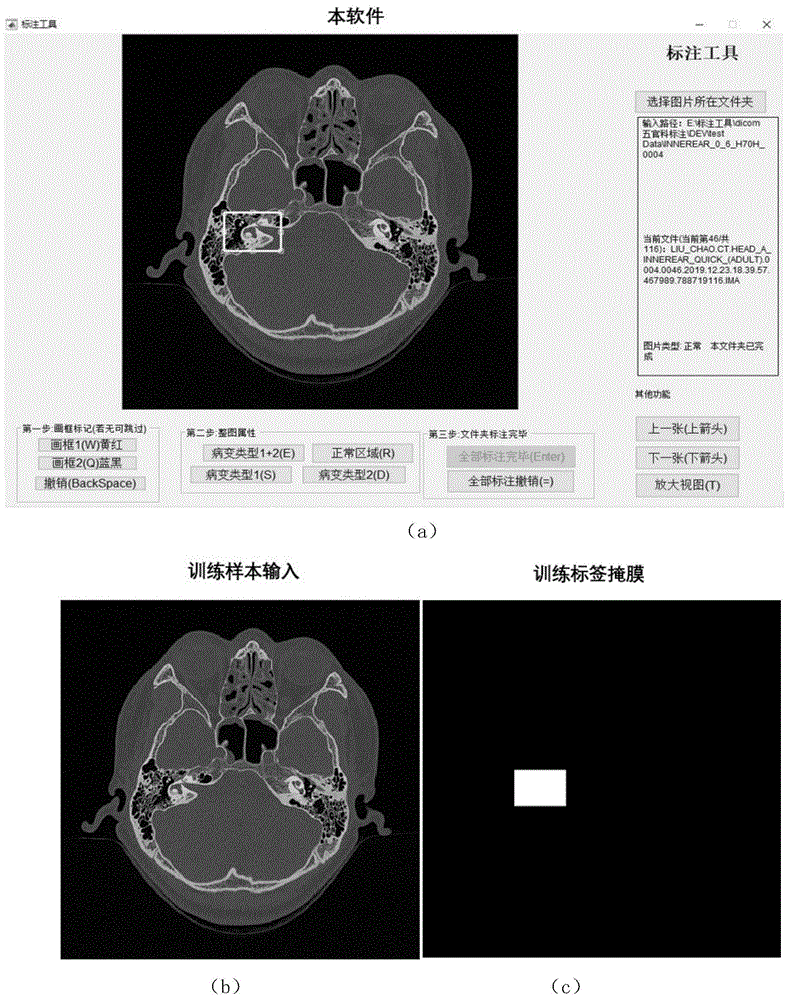 用矩形框标注CT影像并生成深度学习训练样本的系统的制作方法