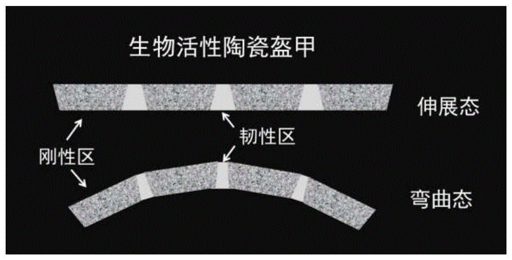 力学适应性的生物活性陶瓷盔甲及其制备方法与流程