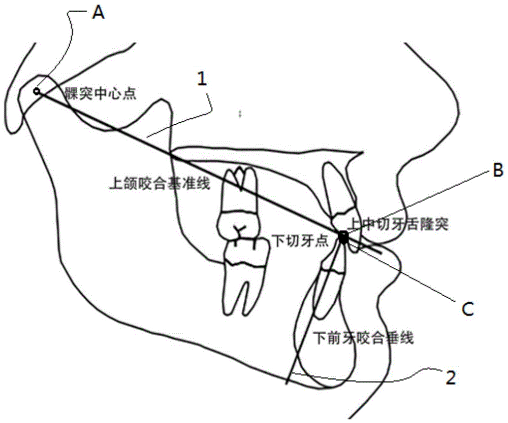 一种用于前牙的牙齿矫正辅助装置及牙齿矫正装置的制作方法