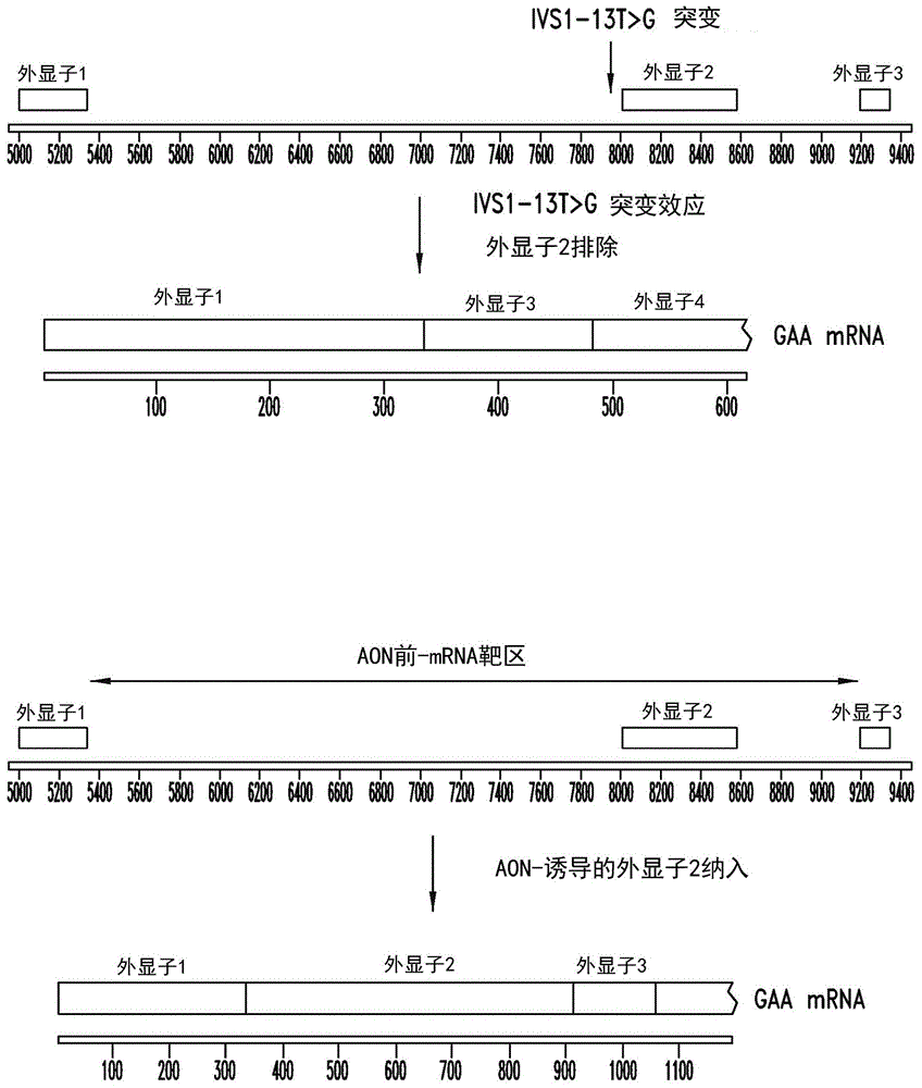 酸性α-葡糖苷酶中反义诱导的外显子2纳入的制作方法