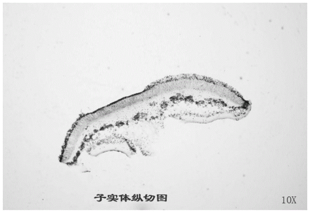 一种地衣子实体显微结构的永久制片方法与流程