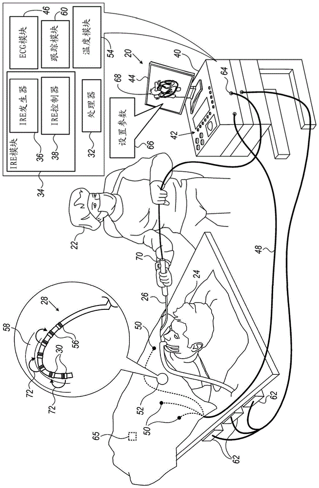 用于不可逆电穿孔的脉冲发生器的制作方法