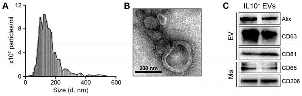 一种细胞外囊泡—白介素-10纳米靶向药物及其制备方法和应用与流程