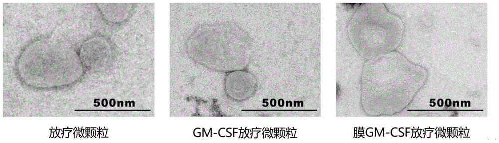 一种经基因工程改造的抗肿瘤微颗粒的制备方法及应用与流程