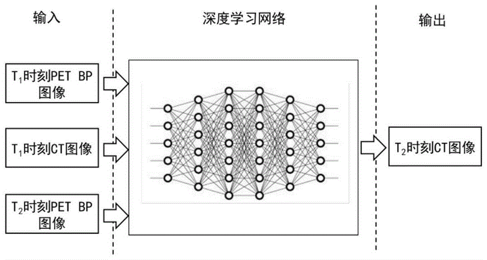 一种用于PET图像衰减校正的CT图像生成方法与流程