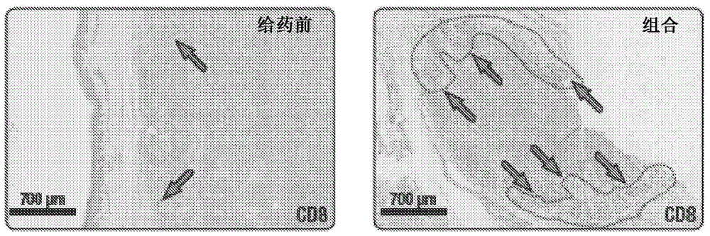 癌症生物标志物及其使用方法与流程