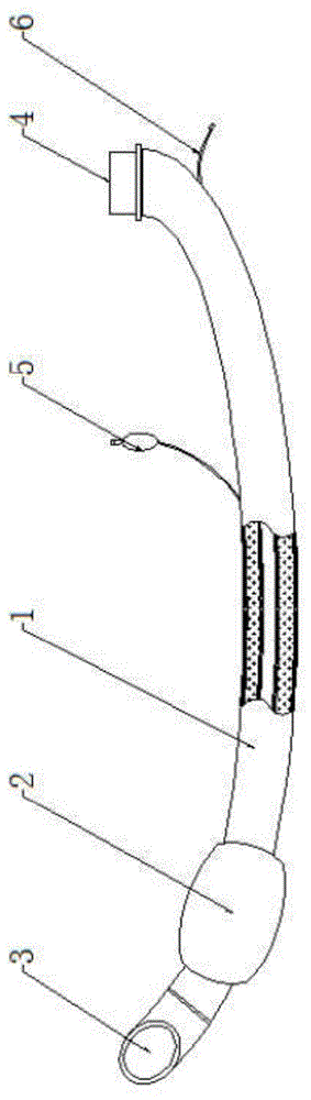 可扩张性气管插管的制作方法