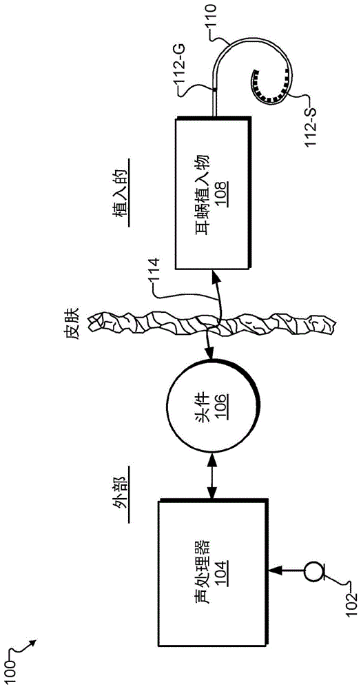 用于探测电极引线距耳蜗组织接近度的系统和方法与流程