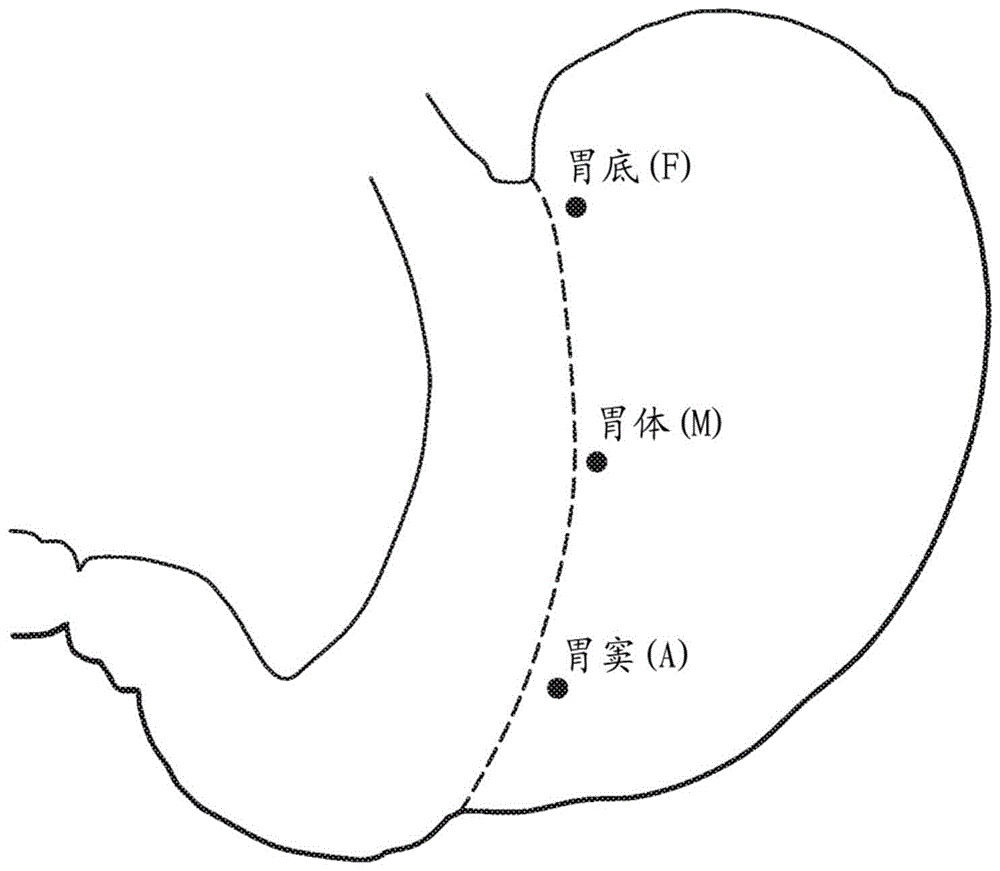 与外科缝合器械一起使用的砧座组件的制作方法