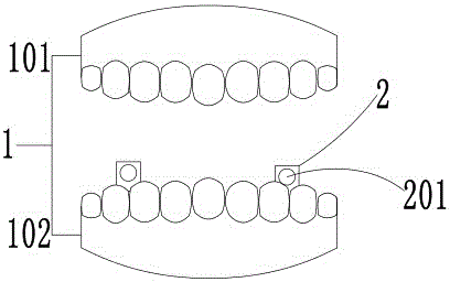 一种新型气管插管固定器的制作方法