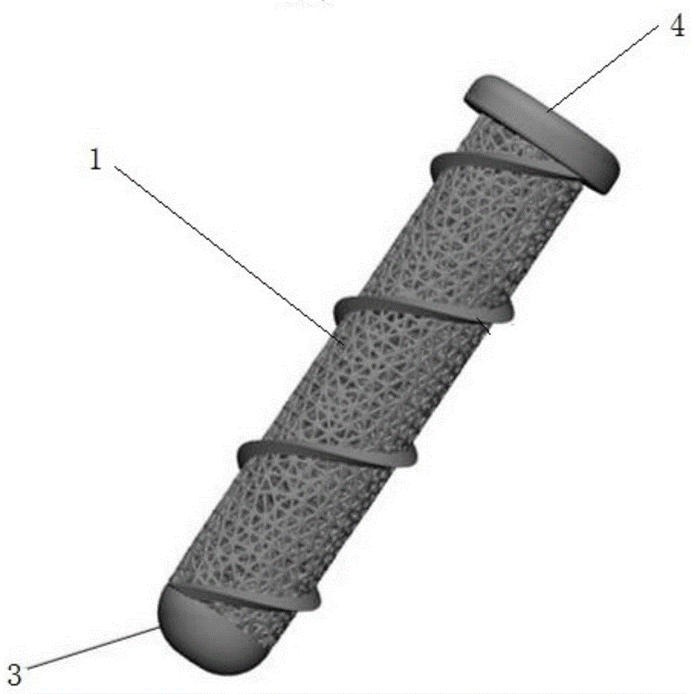 一种随形多孔钛合金紧固结构植入体及其制备方法与流程