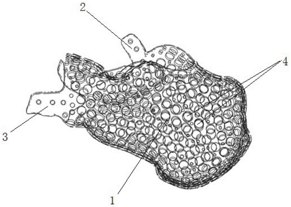 一种钛合金多孔跟骨植入体结构及其加工方法与流程