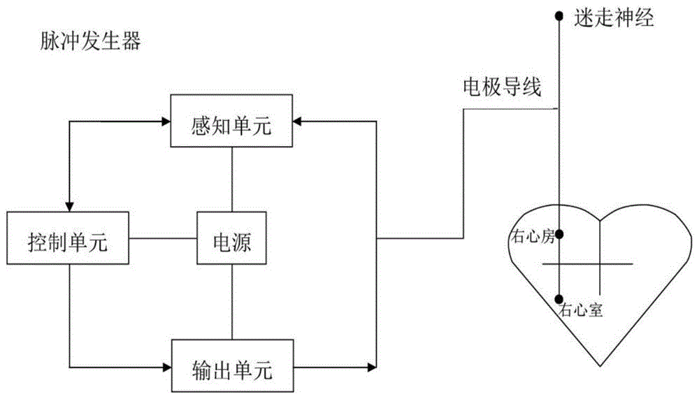 治疗心房颤动且兼具迷走神经刺激功能的心脏起搏装置的制作方法