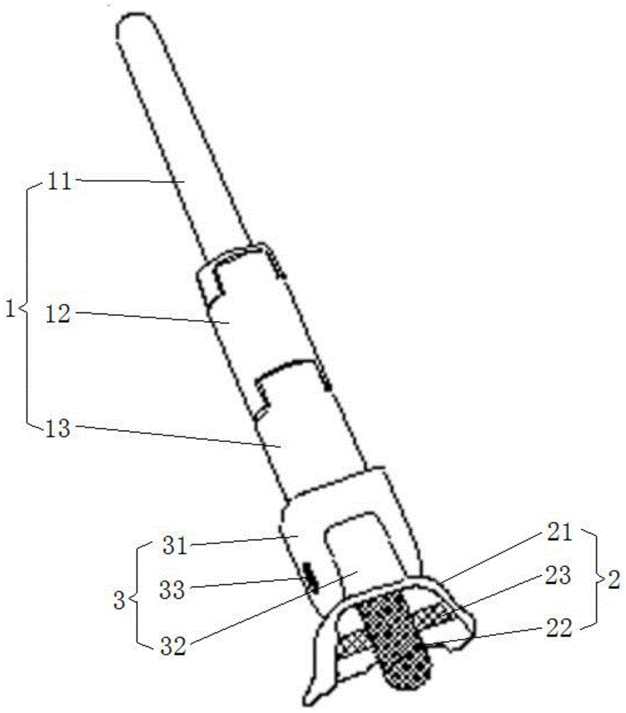 一种组配式肿瘤型人工胫距关节假体的制作方法