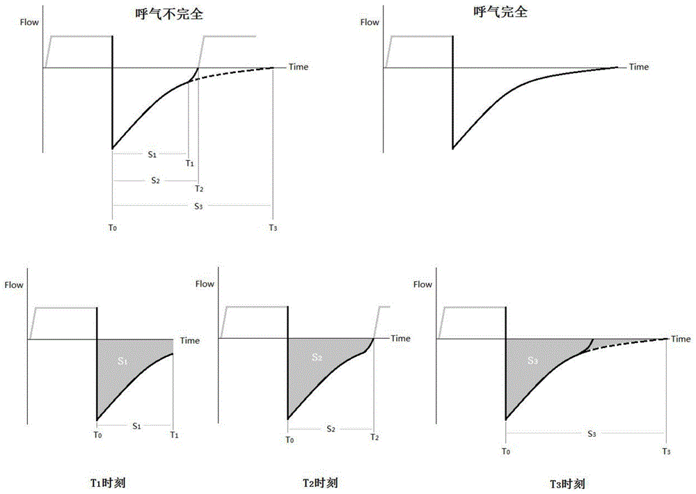 一种机械通气中动态呼气末正压的估测方法与流程