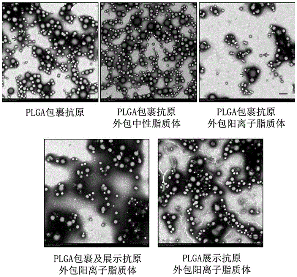 一种带状疱疹疫苗组合物及其制备方法和应用与流程