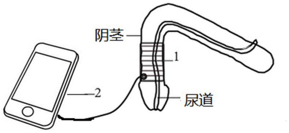 可穿戴柔性超声尿道瘢痕治疗仪的制作方法