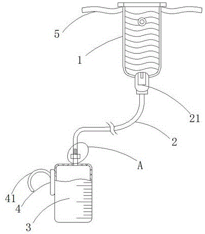 男性留置尿管溢尿用接尿器的制作方法