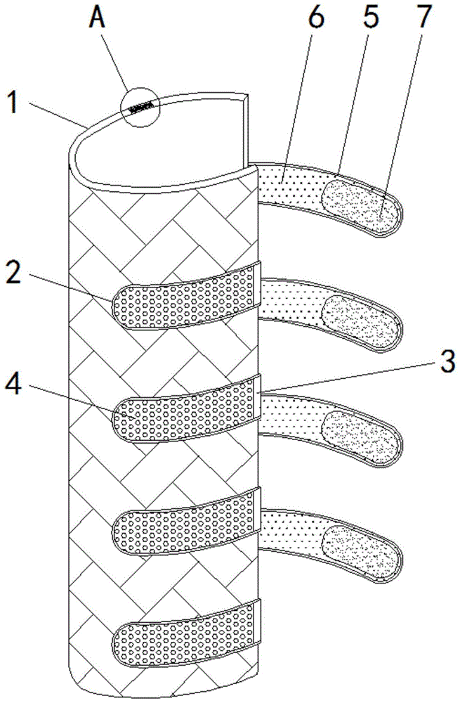 一种高分子骨折夹板的制作方法