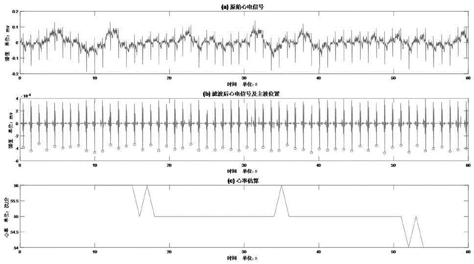 一种基于MODWT的动态心电图实时心率估算方法与流程