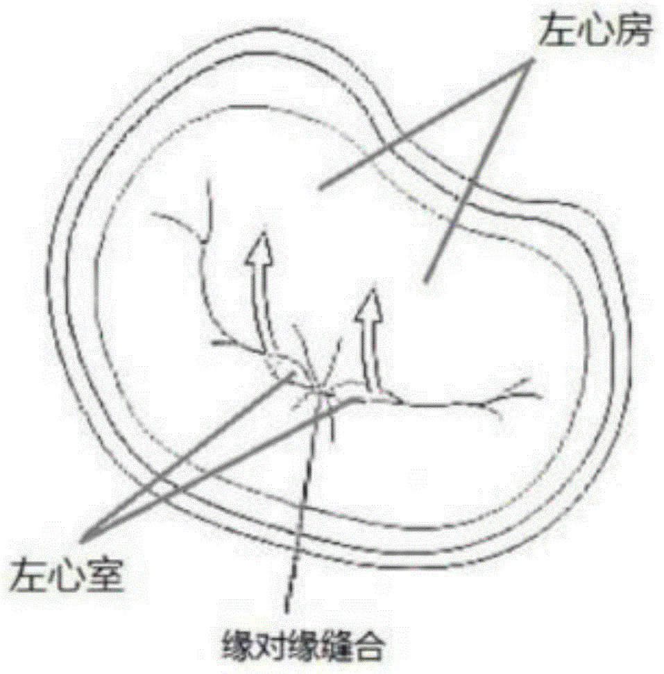 一种经导管心脏瓣膜夹合系统的制作方法