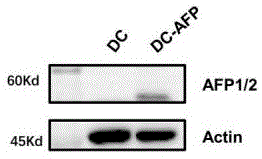 靶向AFP全抗原的DC细胞、CTL细胞及其制备方法和应用与流程