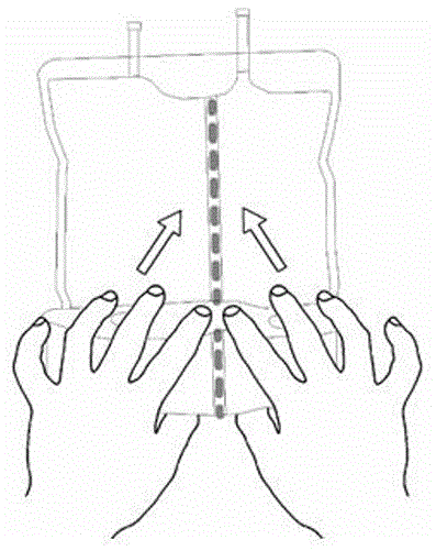 一种双室袋包装脑脊髓手术用冲洗液的制备方法与流程