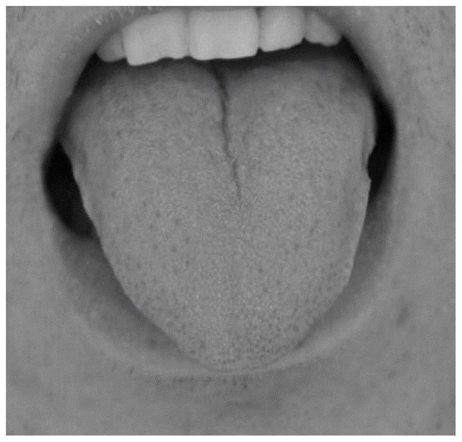 一种基于图像块先验的舌象分割算法的制作方法
