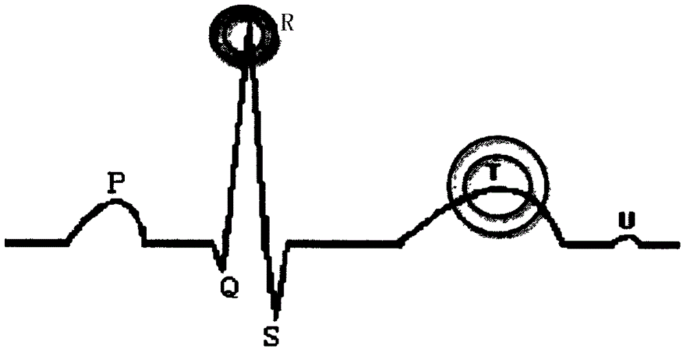 心电图监测数据可视化方法及装置与流程